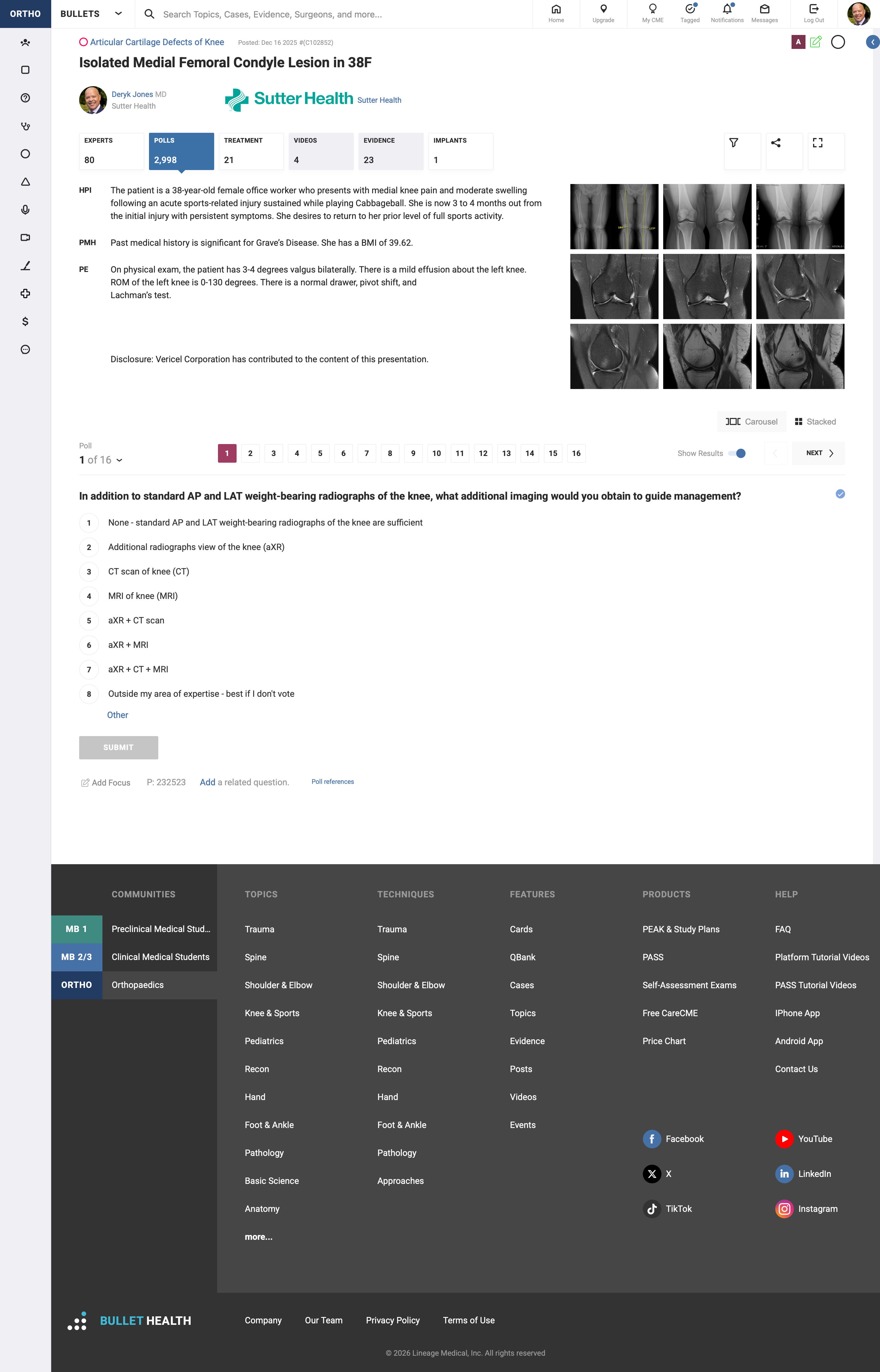 Isolated Medial Femoral Condyle Lesiont